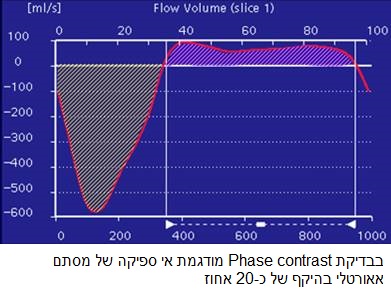 בבדיקת Phase contrast מודגמת אי ספיקה של מסתם אאורטלי בהיקף של כ-20 אחוז